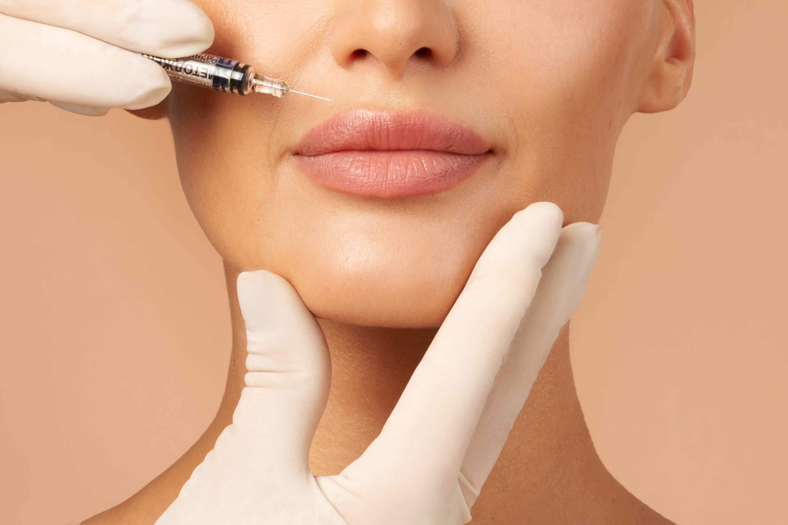 Image of a woman getting her lips injected at Arc Medical Aesthetics Med Spa in Solana Beach, California.